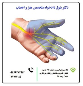 Carpal Tunnel Syndrome 1