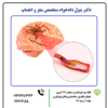 علت تنگی عروق مغزی