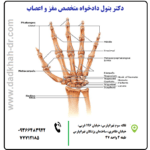 تشخیص و درمان درد دست