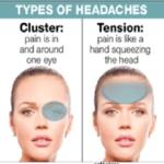علت سردرد بالای سر و چشم